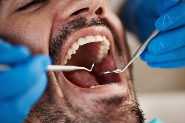 Best Emergency Root Canal Treatment in Elk City, OK